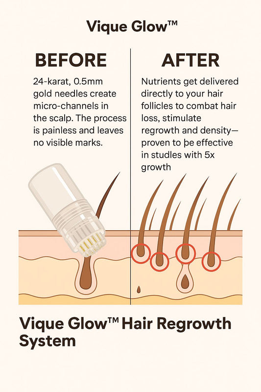 VIQUE™ Microneedle Hair Regrowth Treatment